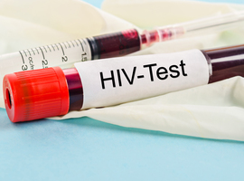 Les diagnostics de VIH en légère hausse en 2021, selon Sciensano