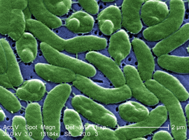 L'ECDC met en garde contre la bactérie Vibrio présente dans l'eau de mer