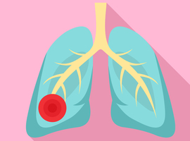 Quelle stratégie thérapeutique  dans la CAP  (Community Acquired Pneumonia)?