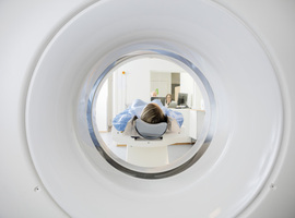 CT-scan lombaire : le CMG interpelle Vandenbroucke