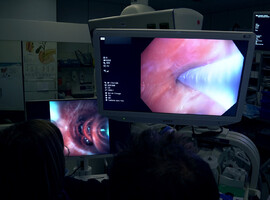 Un nouvel outil endoscopique unique en Wallonie pour la détection précoce des nodules pulmonaires