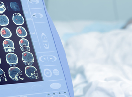 Les hôpitaux du Luxembourg mutualisent l’imagerie médicale