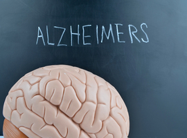 Les Etats-Unis autorisent un nouveau traitement contre Alzheimer