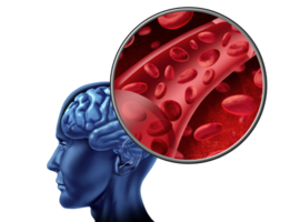 Microbloedingen in de hersenen, antistollingstherapie en bloedingsrisico