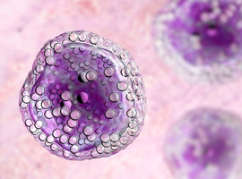 Genetica en pathogenese  van diffuus grootcellig B-cellymfoom