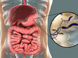 Helicobacter pylori-therapie  voor preventie van  metachrone maagkanker