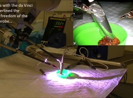 Chirurgische robot met flexibele detector spoort lymfeklier op 