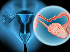 Amiante: les malades du cancer de l'ovaire pourront être indemnisées