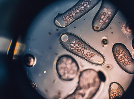 Biologen lanceren schoonheidswedstrijd voor parasieten