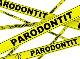 Correlatie tussen parodontitis en het risico op urologische kanker?