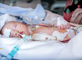 Voeding van kritiek zieke kinderen op intensive care 