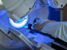 Une première tumeur du col de l'utérus traitée par radiothérapie adaptative en Belgique  