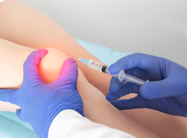 Fenêtre d’opportunité, recommandations internationales sur l’acide hyaluronique et place du patient dans la prise en charge