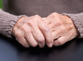 Nieuwe EULAR-aanbevelingen over behandeling van osteoartritis van de hand