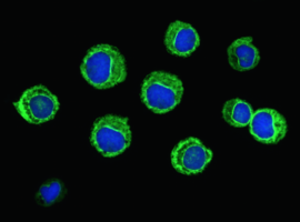 Detectie van antinucleaire antistoffen door middel van indirecte immunofluorescentie