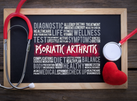 Arthrite psoriasique: une étude de phase II avec le guselkumab