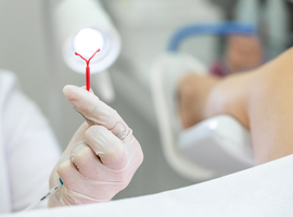 Incidentie en risico van uterusperforatie door Intrauterine Device (IUD): een multisite cohortstudie