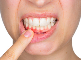 Gum Health Day wil aandacht vestigen op tandvleesproblemen