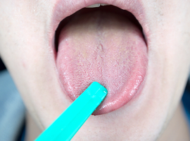 Onderzoek van de tong: wanneer traditionele geneeskunde artificiële intelligentie ontmoet
