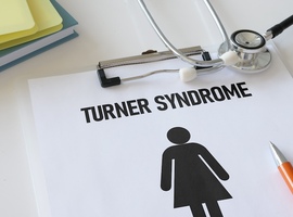 La minipuberté donne un aperçu de la réserve ovarienne chez les filles atteintes du syndrome de Turner