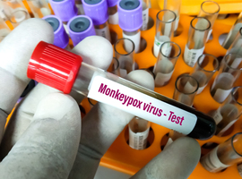 Apenpokken - Binnenkort geen verwijsbrief meer nodig voor vaccin