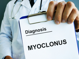 Myoclonus généralisé associé au Covid-19