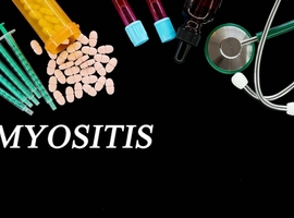 Des premières recommandations pour le dépistage du cancer chez les patients atteints de myosite