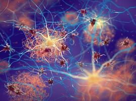 Tomographie par émission de positons d’enchevêtrements de protéines tau dans la neurodégénérescence