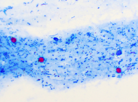 Verdedigingsproces van de microbiota in geval van invasie door een pathogene kiem