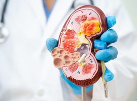 Maladie rénale et diabète: des synergies thérapeutiques neuves et prometteuses!