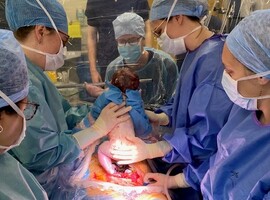Keizersnede: direct contact moeder-baby met nieuw operatiedoek