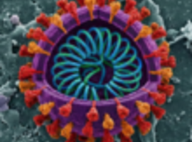 WHO: Lage kans op verspreiding Nipha-virus