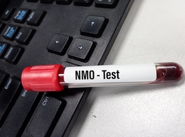 Neuromyélite optique associée aux anticorps anti-AQP4: actualités diagnostiques et thérapeutiques