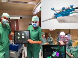 OLV zet robot in voor knieprothesechirurgie 