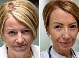 L'ex-ministre Catherine Fonck officialise son retour en milieu hospitalier