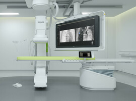 Longkankerbehandeling: innovatieve technologie in twee Belgische ziekenhuizen