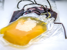 Rode Kruis zal later dit jaar meer plasma kunnen afnemen bij donoren