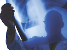 Onderzoek naar geschorste radiologen ZNA Cadix kan nog weken duren