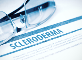 Sclérodermie systémique: une maladie des cellules souches plutôt qu’immunitaire?