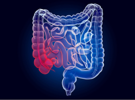 Des études cliniques prometteuses dans les MICI