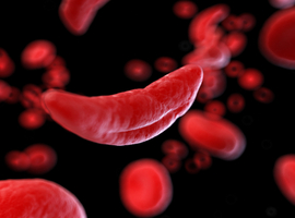 Pas d’augmentation globale du risque de décès ni de MCV liée au trait drépanocytaire