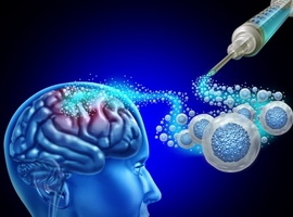 Remplacer les neurones morts dans un AVC: du rêve à la réalité?