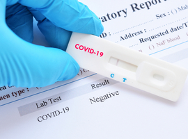 Coronavirus - La Commission européenne conseille aux États membres de renforcer les procédures de test