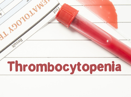 Le rilzabrutinib, un inhibiteur oral de BTK, dans la thrombocytopénie immune