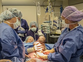 Moeder tilt zelf baby uit buik bij keizersnede: (nog) niet voor België