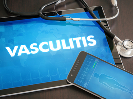 Impact d’une action sur le système du complément dans les vascularites à ANCA