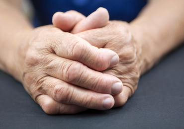 Nieuwe sequentie-analyse definieert vier verschillende trajecten van ontwikkelende reumatoïde artritis