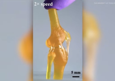 Een functioneel kniegewricht in 3D geprint