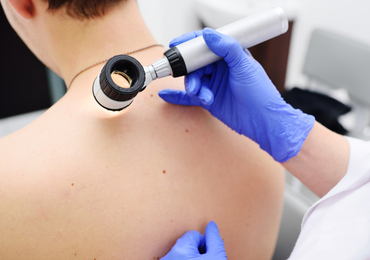 Euromelanoma en Stichting tegen Kanker lanceren campagne voor 