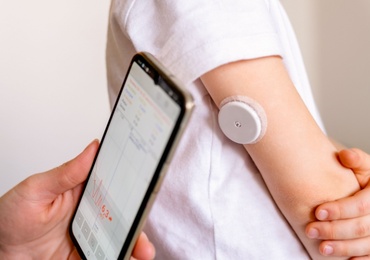 La variabilité glycémique est associée au régime alimentaire, au mode de vie et à la santé chez les personnes non diabétiques